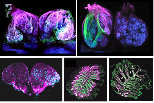 Research by the Calvo lab